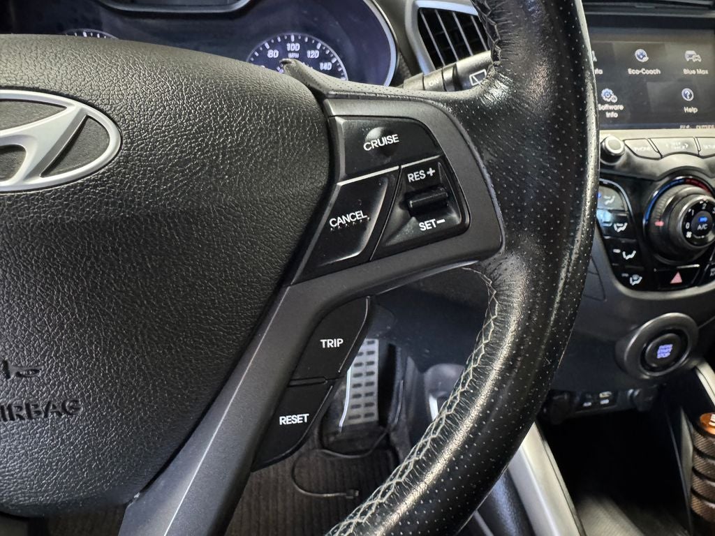 2016 Hyundai Veloster Turbo Exterior Parking Camera Rear